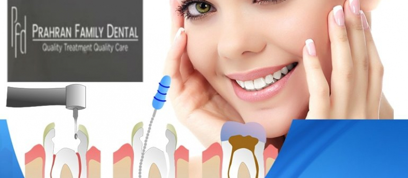 Root Canal Treatment